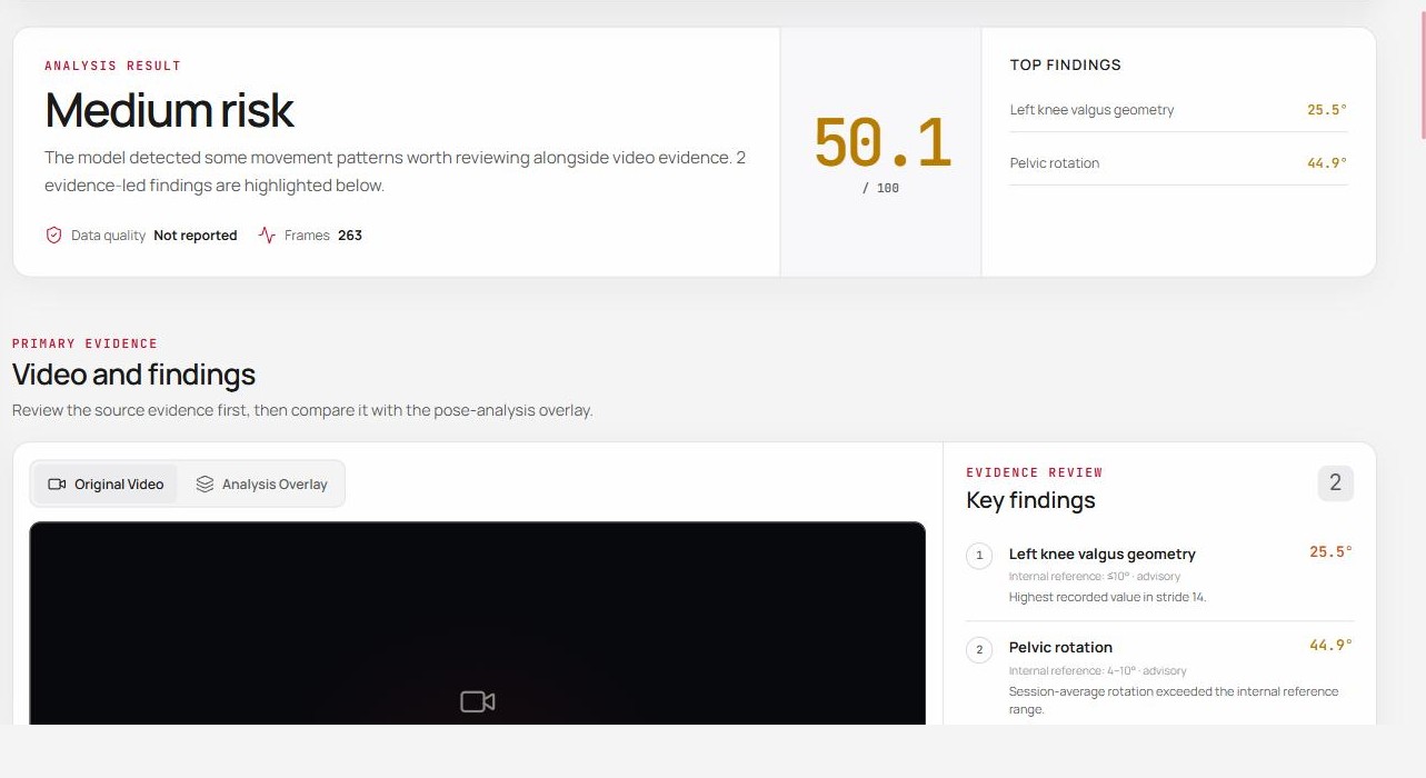 MITUS Analysis — Video and findings screen with pose-analysis overlay